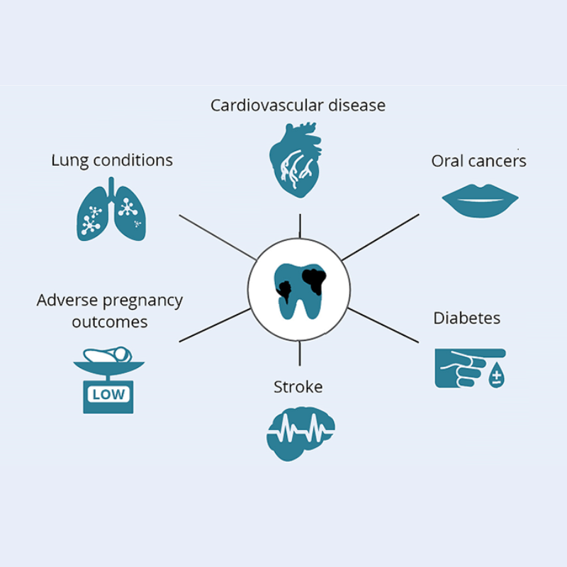 OralVibe™ GlideCleaner
